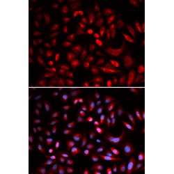 Protein Kinase, cAMP Dependent Catalytic Beta (PRKACB) Antibody