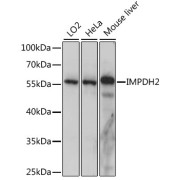 Western blot analysis of extracts of various cell lines using IMPDH2 Antibody (1/1000 dilution).