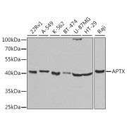 Western blot analysis of extracts of various cell lines using APTX Antibody (1/1000 dilution).