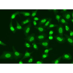 Aprataxin (APTX) Antibody