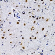 Immunohistochemistry of paraffin-embedded Rat brain using ID3 Antibody (1/200 dilution, 40x lens).