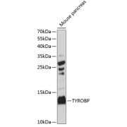 Western blot analysis of extracts of mouse pancreas using TYROBP Antibody (1/3000 dilution).