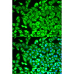 Fructose-1,6-Bisphosphatase 1 (FBP1) Antibody