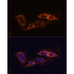 Receptor Interacting Serine Threonine Kinase 3 (RIPK3) Antibody