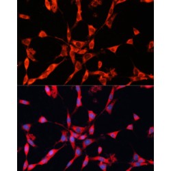 Glycyl-tRNA Synthetase (GARS1) Antibody