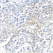 Immunohistochemistry of paraffin-embedded Human tonsil using HSD17B10 Antibody (1/100 dilution, 40x lens).