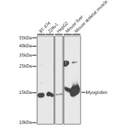 Western blot analysis of extracts of various cell lines using Myoglobin Antibody (1/1000 dilution).