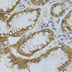 sigma R1 Antibody