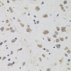 sigma R1 Antibody