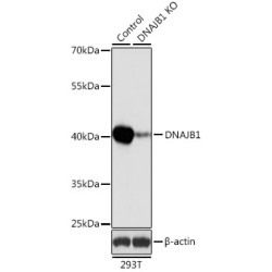 DnaJ (Hsp40) Homolog, Subfamily B, Member 1 (DNAJB1) Antibody