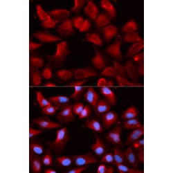 DnaJ (Hsp40) Homolog, Subfamily B, Member 1 (DNAJB1) Antibody