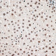 Immunohistochemistry of paraffin-embedded Rat liver using CBX6 Antibody (1/100 dilution, 40x lens).