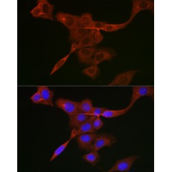 Tyrosine-protein kinase JAK1 (JAK1) Antibody