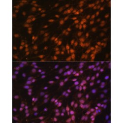 Far Upstream Element (FUSE) Binding Protein 1 (FUBP1) Antibody