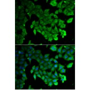 Immunofluorescence analysis of HeLa cells using LC3A/LC3B Antibody