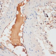 Immunohistochemistry of paraffin-embedded Human lung using APOC1 Antibody (1/100 dilution, 40x lens).