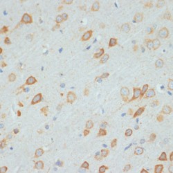 DEAD-Box Helicase 3, X-Linked (DDX3X) Antibody