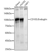 Western blot analysis of various lysates using CD105/Endoglin Antibody (1/1500 dilution).