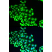 Immunofluorescence analysis of HeLa cells using ERCC2 Antibody