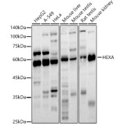 Western blot analysis of extracts of various cell lines using HEXA Antibody (1/1000 dilution).