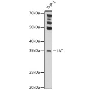 Western blot analysis of extracts of THP-1 cells using LAT Antibody(1/1000 dilution).