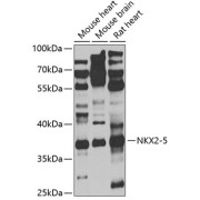 Western blot analysis of extracts of various cell lines using NKX2-5 Antibody (1/1000 dilution).