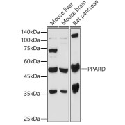 Western blot analysis of extracts of various cell lines using PPARD Antibody (1/1000 dilution).