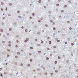 Peroxisome Proliferator Activated Receptor Delta (PPARD) Antibody