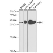 Western blot analysis of extracts of various cell lines using EPO Antibody (1/50 dilution)0.