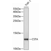 Western blot analysis of extracts of THP-1 cells using CSTA Antibody (1/1000 dilution).