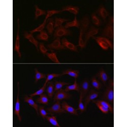 Protein Kinase C Zeta Type (PRKCZ) Antibody