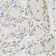 Immunohistochemistry of paraffin-embedded Human stomach using RUVBL1 Antibody (1/100 dilution, 40x lens).