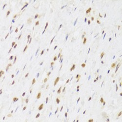 RuvB-Like 1/Pontin 52 (RUVBL1) Antibody