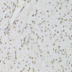 RuvB-Like 1/Pontin 52 (RUVBL1) Antibody