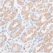 Immunohistochemistry of paraffin-embedded Human stomach using PAEP Antibody (1/100 dilution, 40x lens).