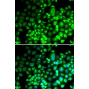 Immunofluorescence analysis of HeLa cells using ST6GAL1 Antibody