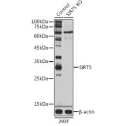 Western blot analysis of extracts from normal (control) and SIRT5 knockout (KO) 293T cells, using SIRT5 Antibody (1/1000 dilution).