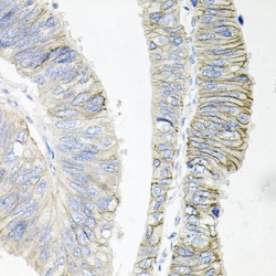 ATPase, Na+/K+ Transporting Beta 1 Polypeptide (ATP1B1) Antibody