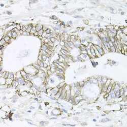 ATPase, Na+/K+ Transporting Beta 1 Polypeptide (ATP1B1) Antibody