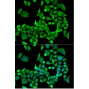 Immunofluorescence analysis of U2OS cells using PPP2R1A Antibody