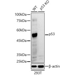 Cellular Tumor Antigen P53 (TP53) Antibody