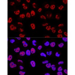 Cellular Tumor Antigen P53 (TP53) Antibody