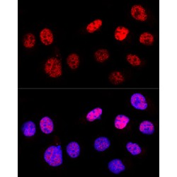 Cellular Tumor Antigen P53 (TP53) Antibody