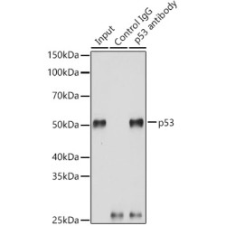 Cellular Tumor Antigen P53 (TP53) Antibody