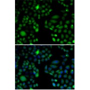 Immunofluorescence analysis of U2OS cells using EPC1 Antibody