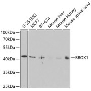 Western blot analysis of extracts of various cell lines using BBOX1 Antibody (1/1000 dilution).