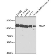 Western blot analysis of extracts of various cell lines using COMP Antibody (1/1000 dilution).