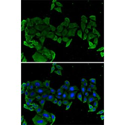 Cartilage Oligomeric Matrix Protein (COMP) Antibody