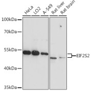 Western blot analysis of extracts of various cell lines using EIF2S2 Antibody (1/3000 dilution).