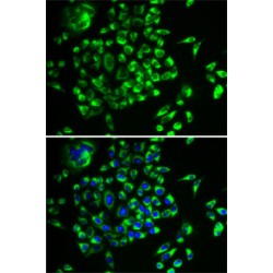 Mitochondrial Ribosomal Protein L28 (MRPL28) Antibody